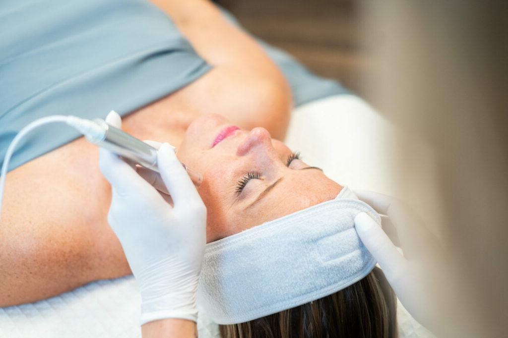 Microneedling treatment being performed 